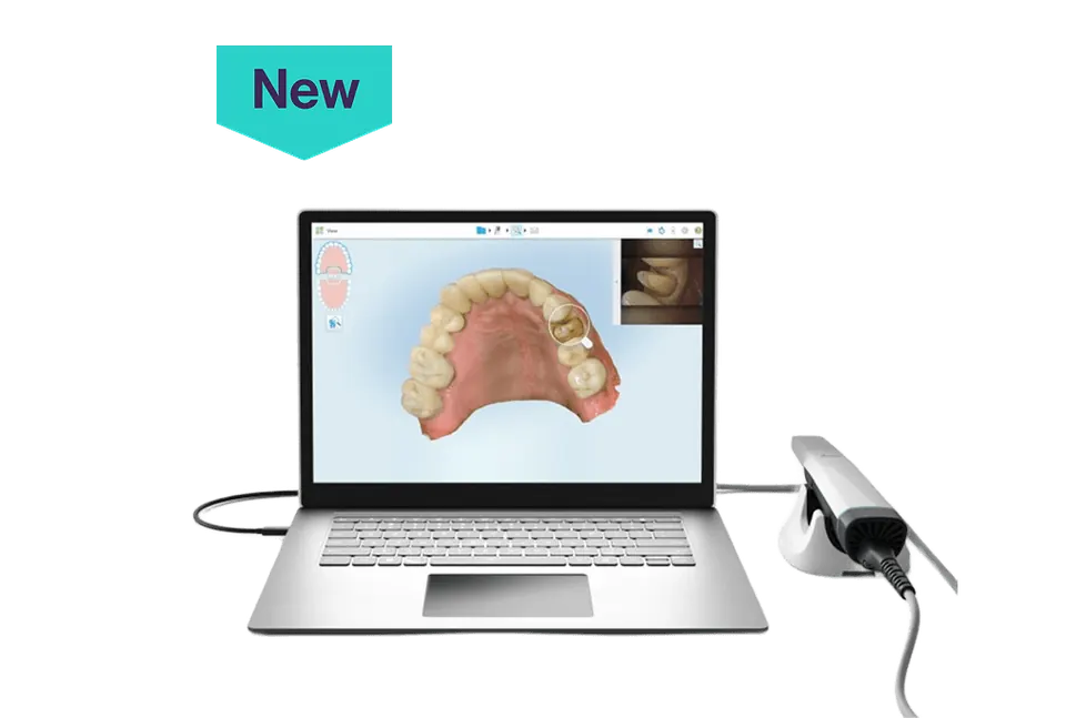 iTero Lumina intraoral scanner image for price comparison context