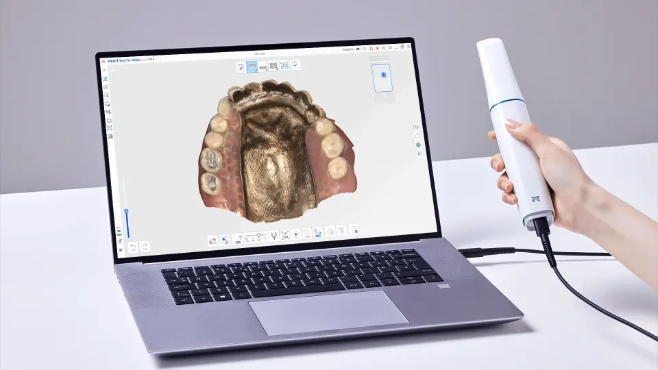 Medit i900 intraoral scanner image for evidence-based review context